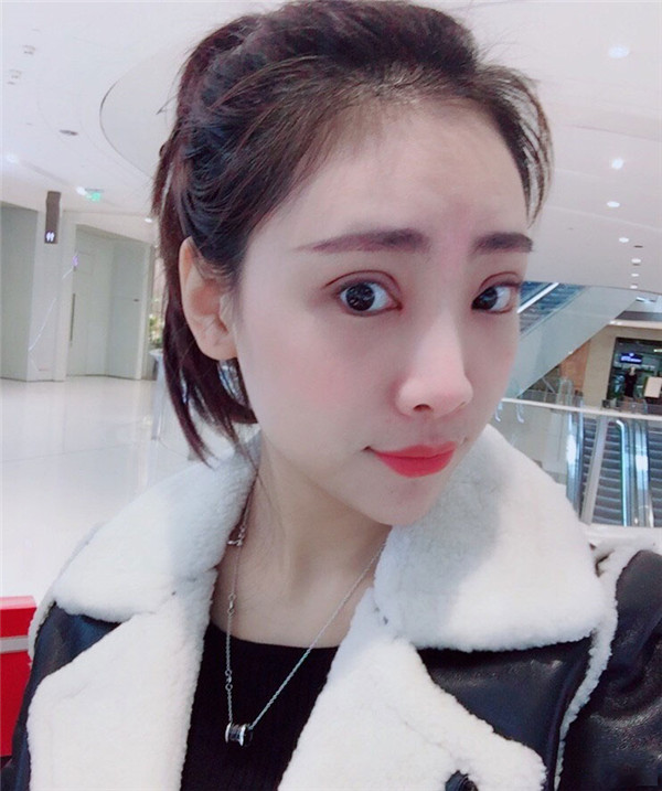 上海悦莱眼部手术怎么样?价格案例