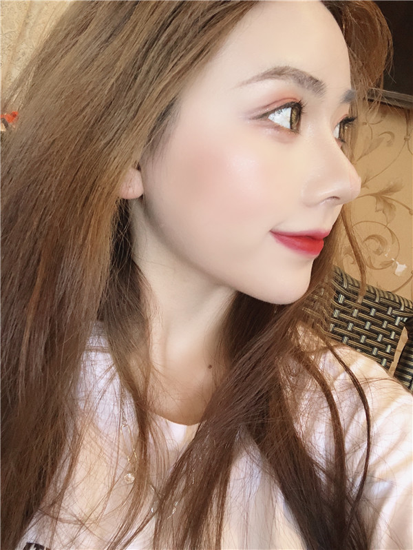 云南华美美莱隆鼻靠谱吗?价格案例