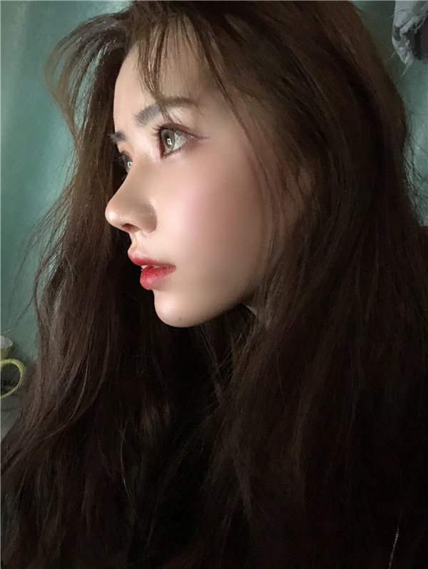 云南华美美莱隆鼻靠谱吗?价格案例