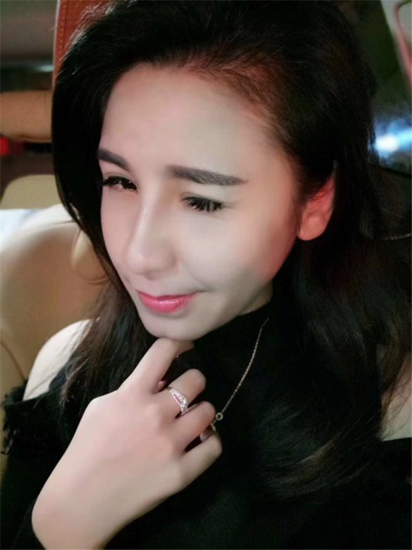 南京红颜会王凯军隆鼻怎么样?价格案例