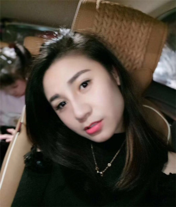 南京红颜会王凯军隆鼻怎么样?价格案例
