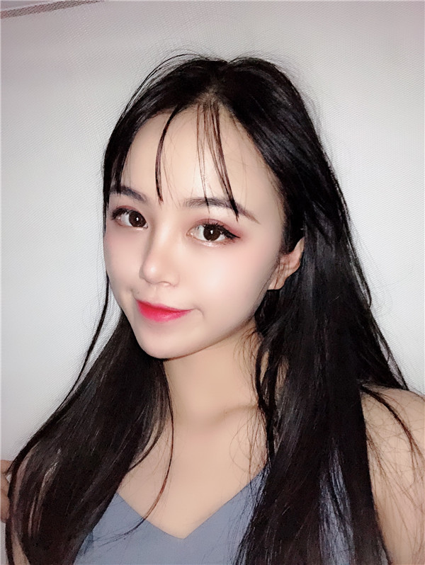 广州康华清雷文刚M唇手术怎么样?价格案例