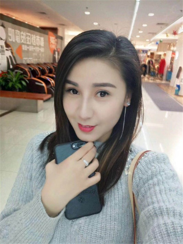 南京红颜会假体隆鼻怎么样?价格案例