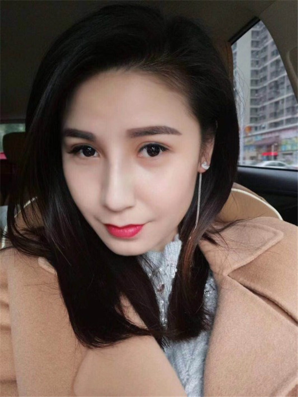 南京红颜会假体隆鼻怎么样?价格案例