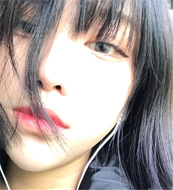 温州百佳东方整形隆鼻怎么样?价格案例