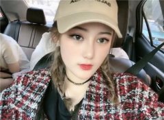 绍兴越城歆菲双眼皮怎么样？价格案例