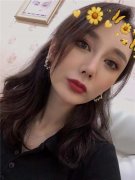 济南爱容整形术杰双眼皮怎么样？价格案例