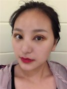 重庆亚美蜜园田学勤怎么样？价格案例