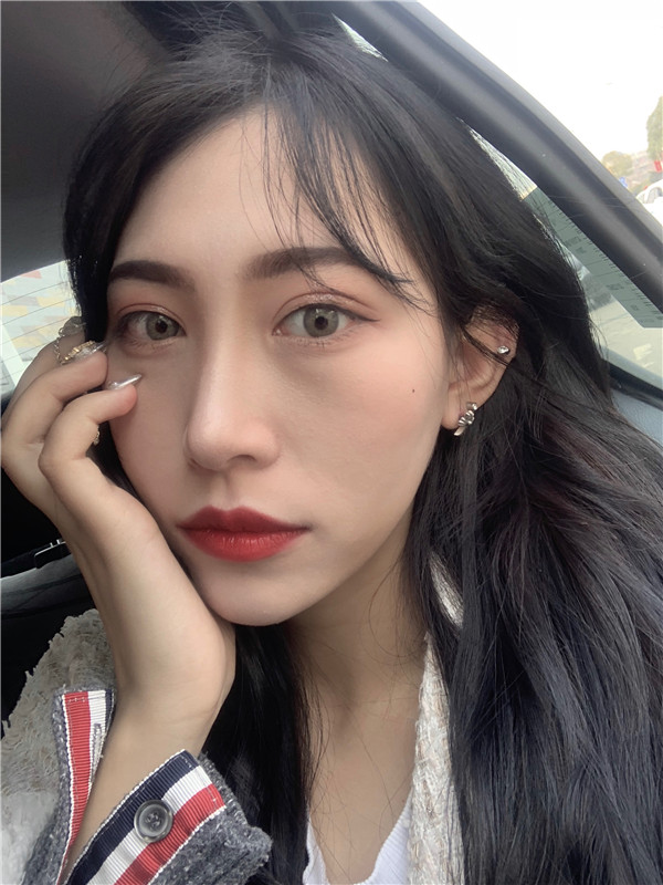 长沙半岛眼部手术怎么样?价格案例