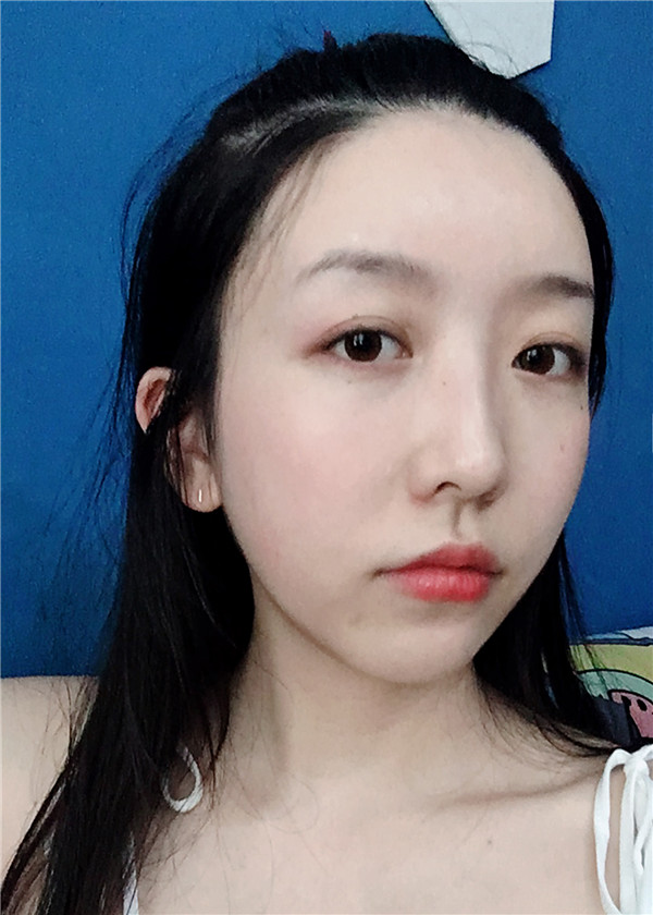 金陵嘉怡美吸脂怎么样?价格案例