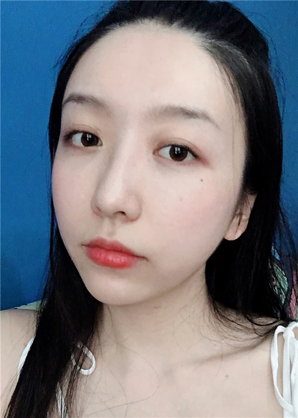 金陵嘉怡美吸脂怎么样?价格案例