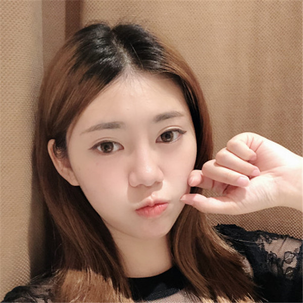 烟台华怡双眼皮怎么样?价格案例