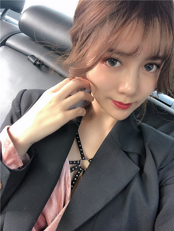 河南整形医院双眼皮怎么样?价格案例