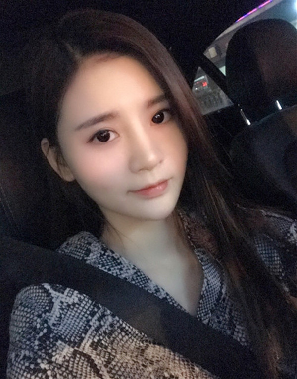 哈尔滨韩美脂肪丰卧蚕怎么样?价格案例