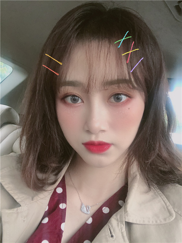 杭州艾尔莎奥拉克双眼皮怎么样?价格案例
