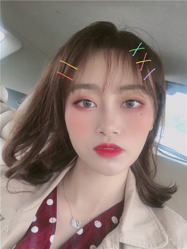 杭州艾尔莎奥拉克双眼皮怎么样?价格案例