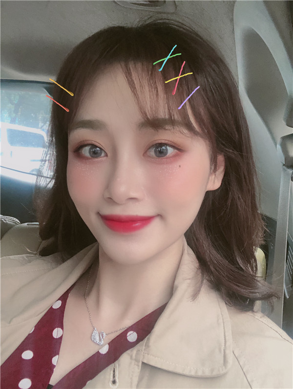 杭州艾尔莎奥拉克双眼皮怎么样?价格案例
