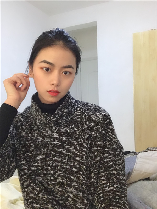 长春西之米双眼皮怎么样?价格案例