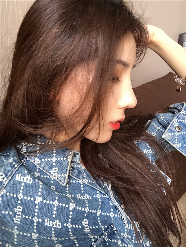 云南华美美莱隆鼻怎么样?价格案例