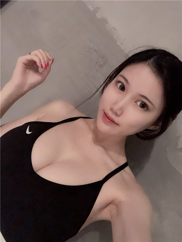 杭州珈禾隆胸怎么样?价格案例