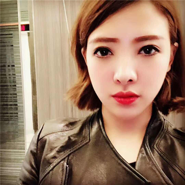 重庆联合丽格双眼皮怎么样?价格案例