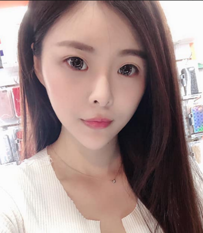 常州美贝尔鼻部手术怎么样?价格案例