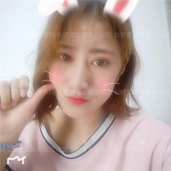 合肥壹加壹眼部手术怎么样?价格案例