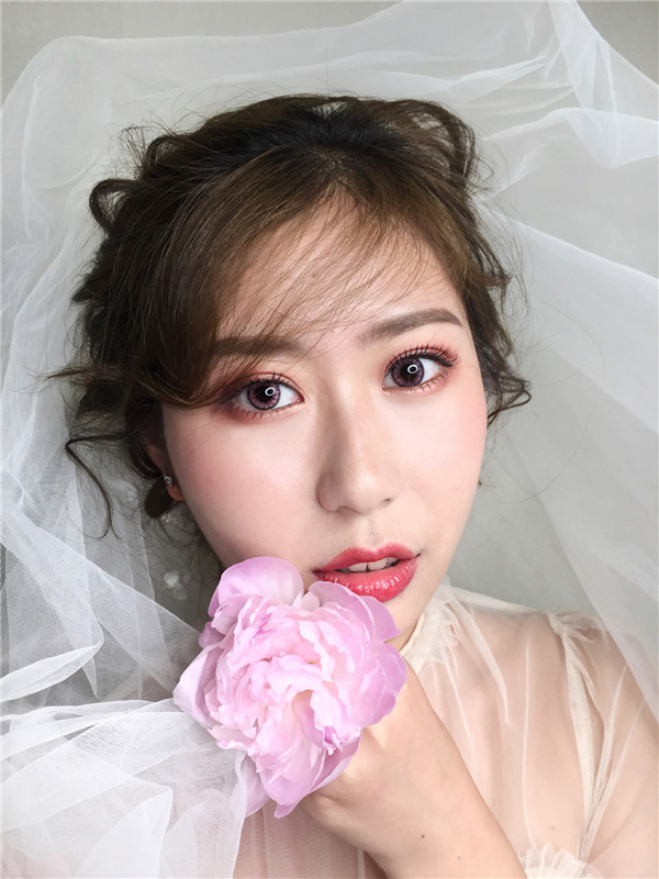 厦门安黛美隆鼻怎么样?价格案例