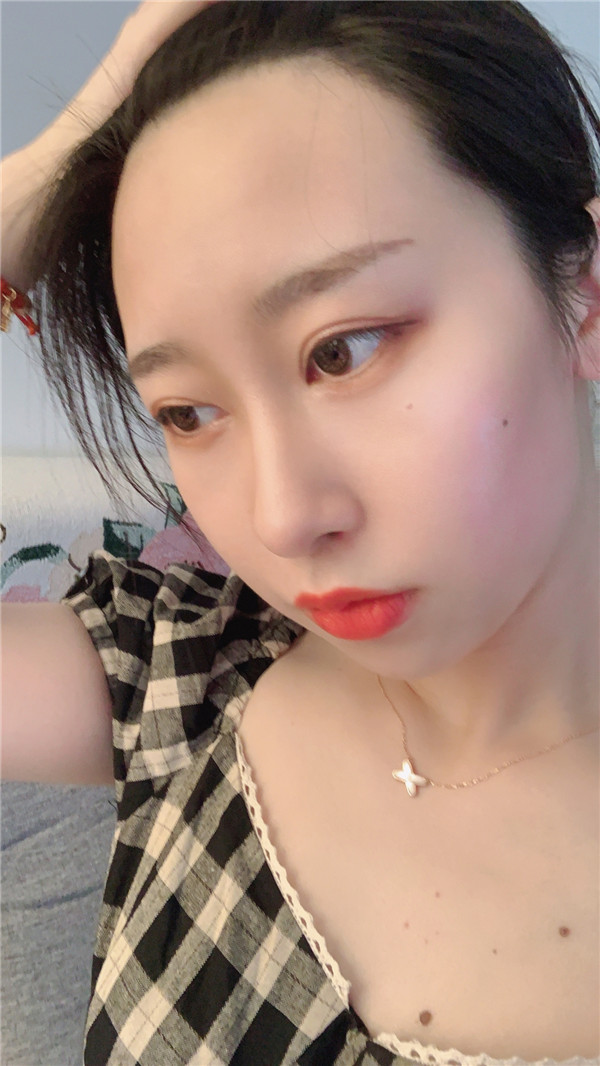 杭州雍禾植发怎么样?价格案例