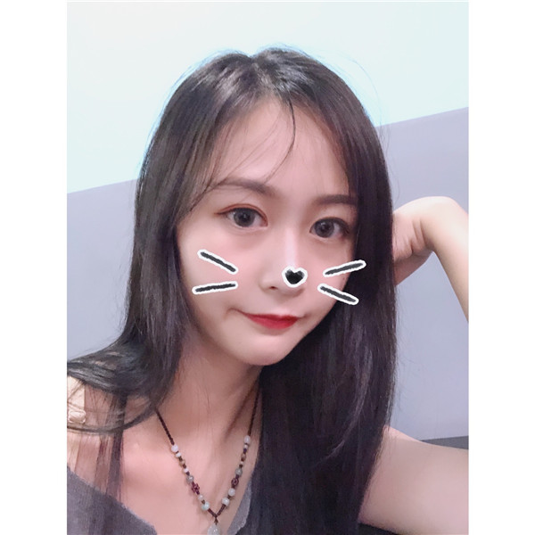 东莞维多利亚双眼皮怎么样?价格案例