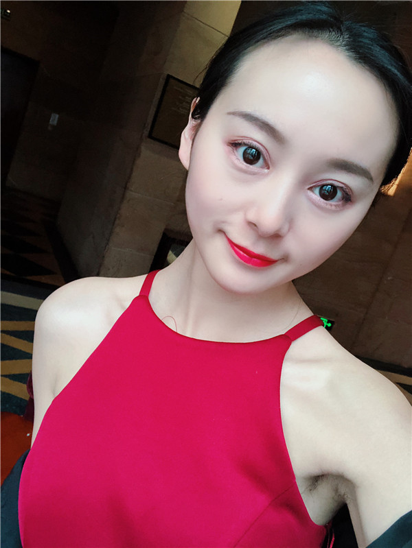重庆瑞俪面部吸脂怎么样?价格案例