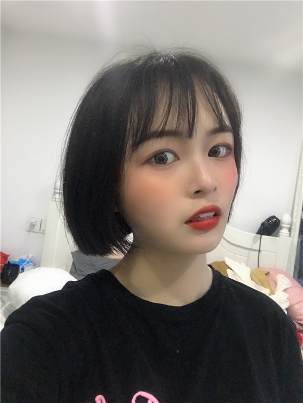 杭州艺星脂肪填充怎么样?价格案例