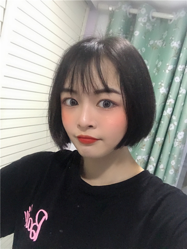 杭州艺星脂肪填充怎么样?价格案例