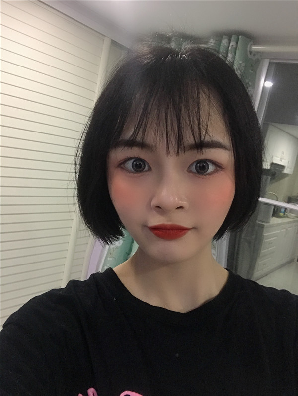杭州艺星脂肪填充怎么样?价格案例