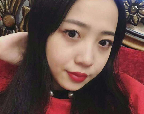 昆山时光脂肪填充怎么样?价格案例