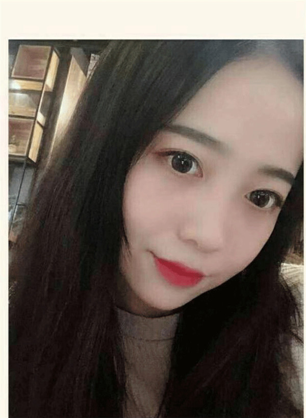 昆山时光脂肪填充怎么样?价格案例