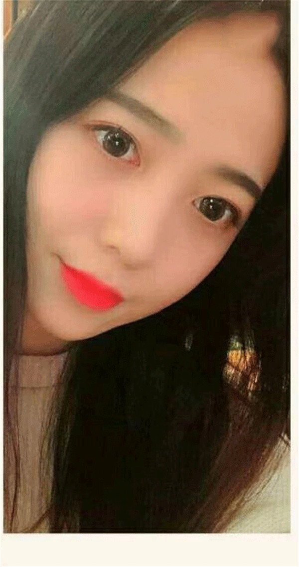 昆山时光脂肪填充怎么样?价格案例