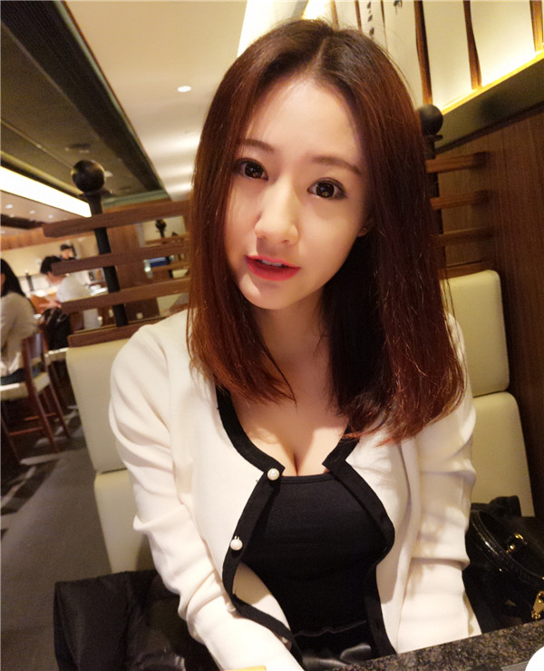 长沙麟颐脂肪丰额头怎么样?价格案例