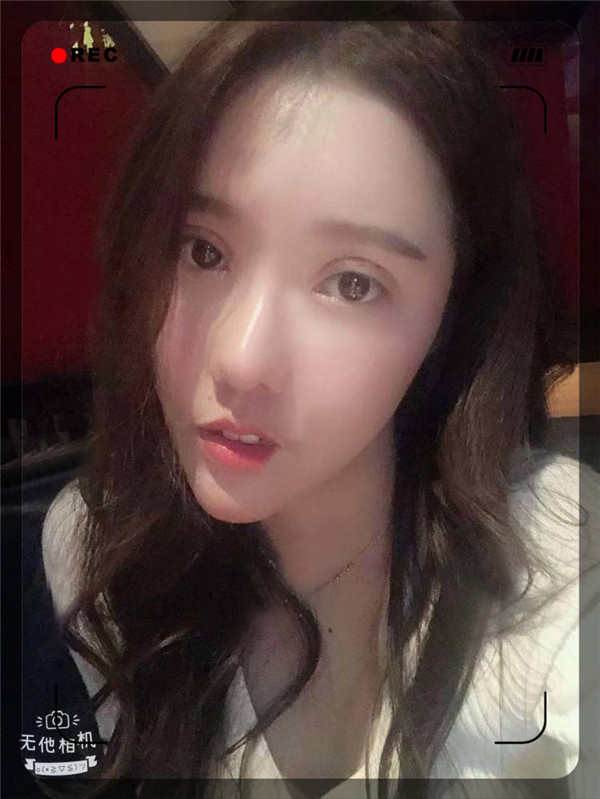 石家庄贵美人双眼皮怎么样?价格案例
