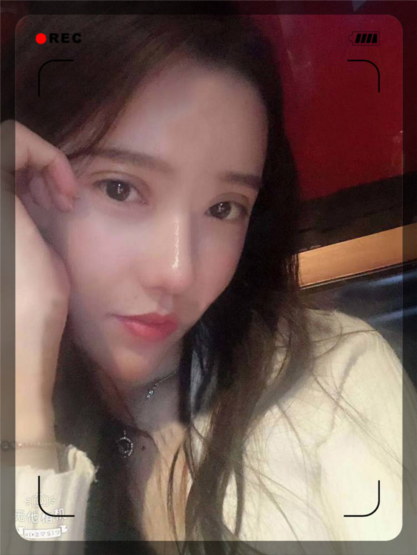 石家庄贵美人双眼皮怎么样?价格案例
