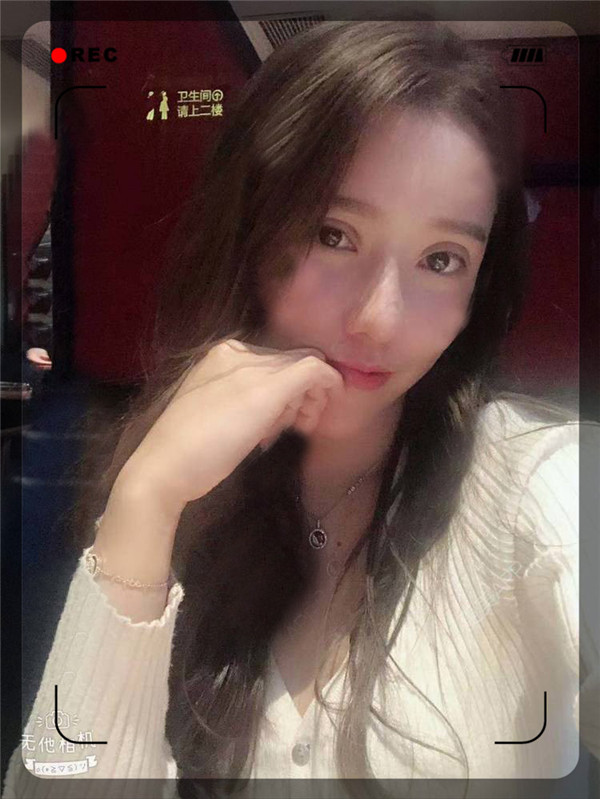 石家庄贵美人双眼皮怎么样?价格案例