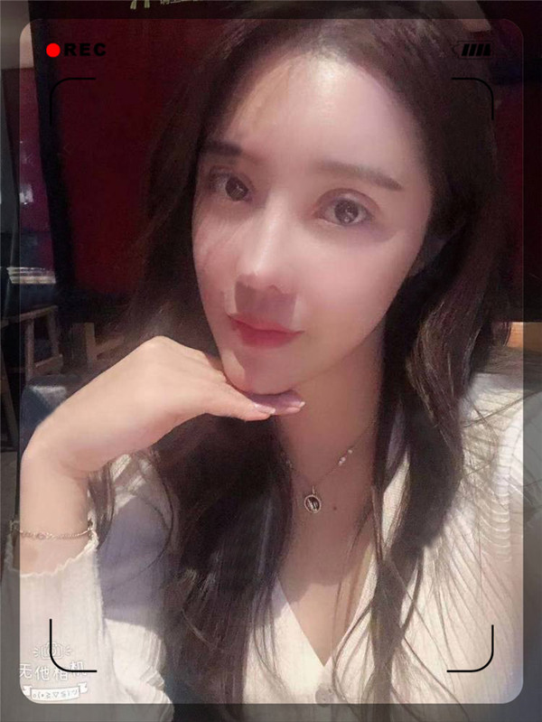 石家庄贵美人双眼皮怎么样?价格案例