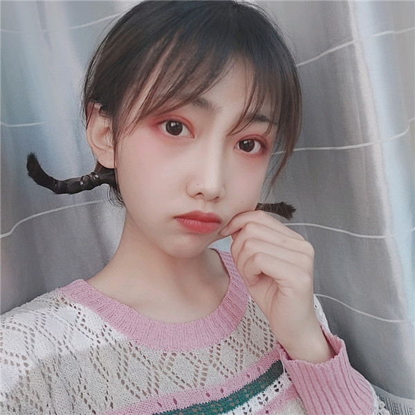 秦皇岛巧致双眼皮怎么样?价格案例