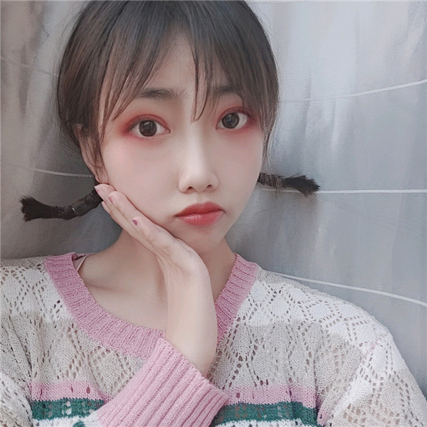 秦皇岛巧致双眼皮怎么样?价格案例