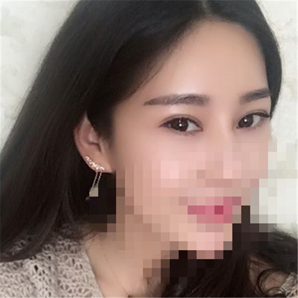 武汉中翰整形眼部手术怎么样?价格案例