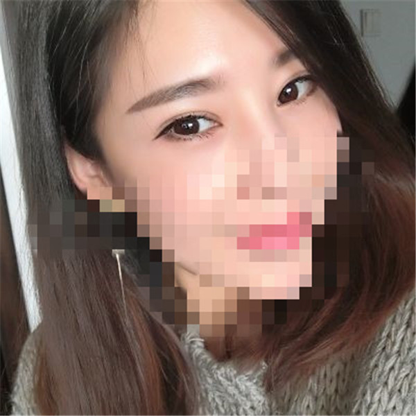 武汉中翰整形眼部手术怎么样?价格案例