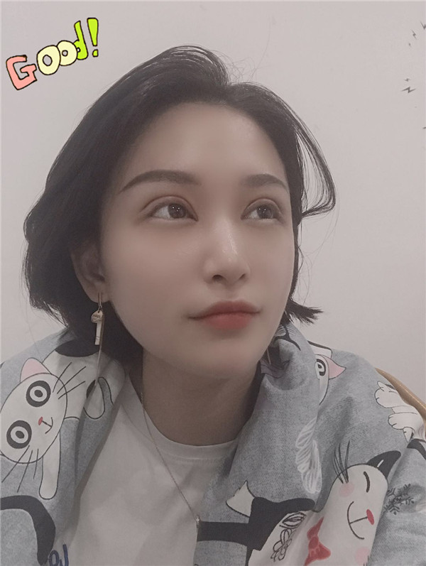 合肥壹美尚眼整形怎么样