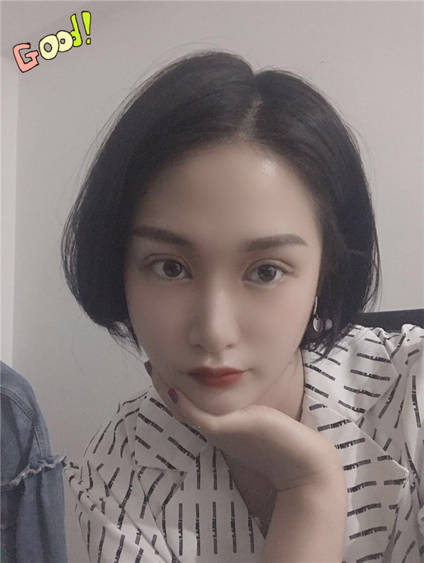 合肥壹美尚眼整形怎么样