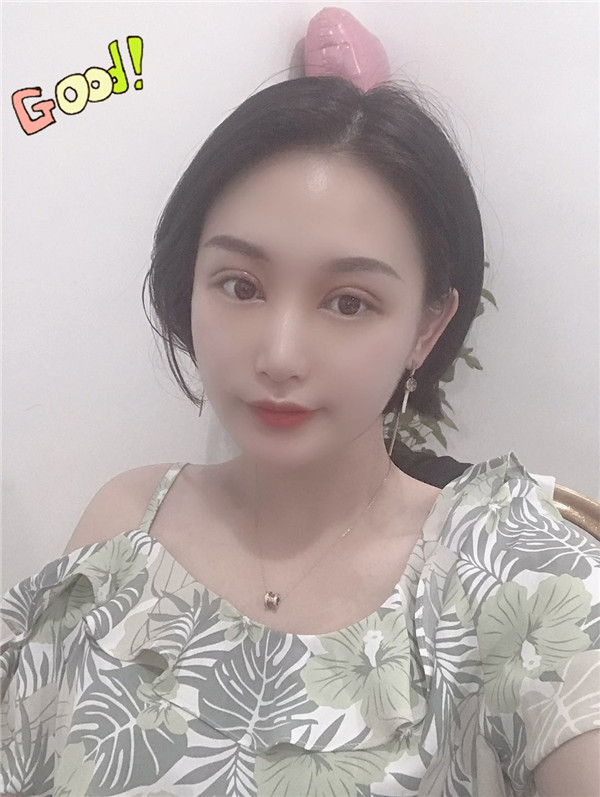合肥壹美尚眼整形怎么样
