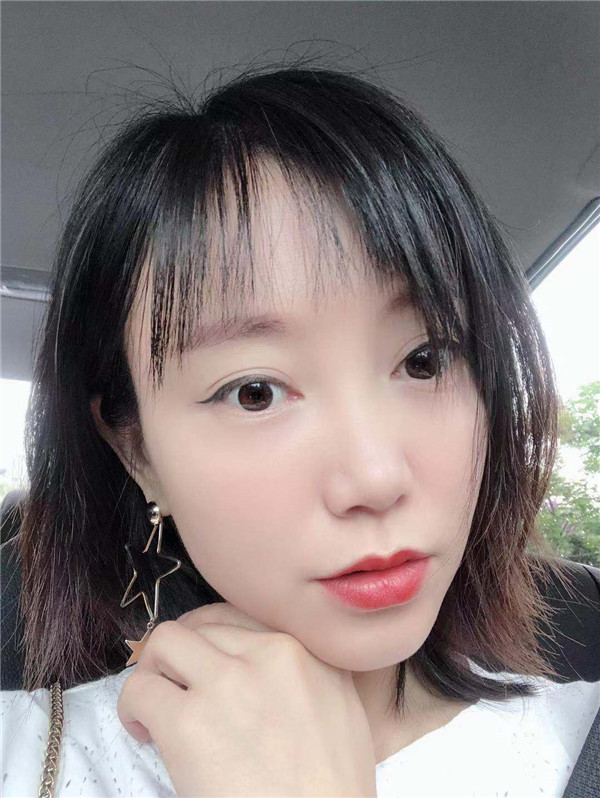 深圳丽港丽格脂肪填充怎么样